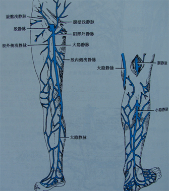 如严重瓣膜功能障碍,深静脉血栓等,可以出现下肢