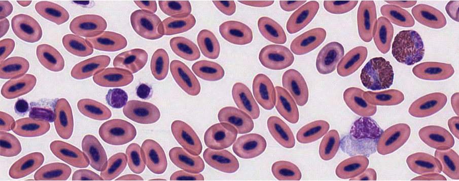 为什么人的红细胞没有细胞核?