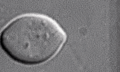 酵母菌出芽生殖图片