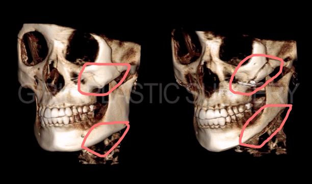 Angelababy医院验证无整容，竟然了 | 美丽也是技术活小组 | 果壳网 科技有意思