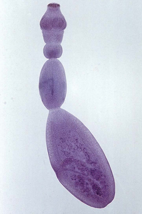 细粒棘球绦虫。图片来自http://echinococcus.seebyseeing.net/