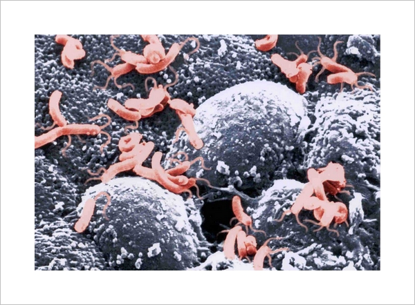 幽门螺杆菌，又名幽门螺旋菌，首先由巴里·马歇尔（Barry J. Marshall）和他的同事罗宾·沃伦（J. Robin Warren）二人发现，两人因证明幽门螺杆菌是大多数胃溃疡和胃炎的成因，而获得了 2005 年的诺贝尔生理学或医学奖。（图片：hefitrx.com）