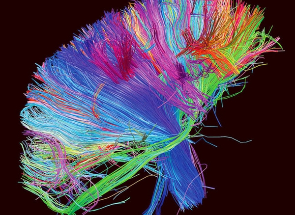 “人脑连接组计划”（Human Connectome Project）利用扫描数据绘制的脑细胞髓鞘分布图。髓鞘是包在神经元分支外面的白色膜层，成分是髓磷脂。髓磷脂含量分布是表示神经元分支和信息传递速度的重要指标。人脑连接组计划准备用5年时间绘制出人脑的线路图。