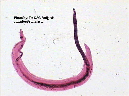 血吸虫雌雄成虫照。较大的为雄虫，中间暗色的雌虫嵌合在雄虫的抱雌沟内。图片来自：sums.ac.ir。
