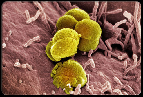 显微镜下的淋病奈瑟菌