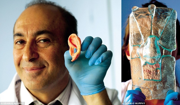 左图：拿着自己制作的耳朵的Seifalian教授。右图：他们实验室制作鼻子时使用的患者面部玻璃模具。