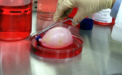 培养液中的生物降解材料做成的膀胱模具。细胞会在这个模具上长出膀胱的形状。