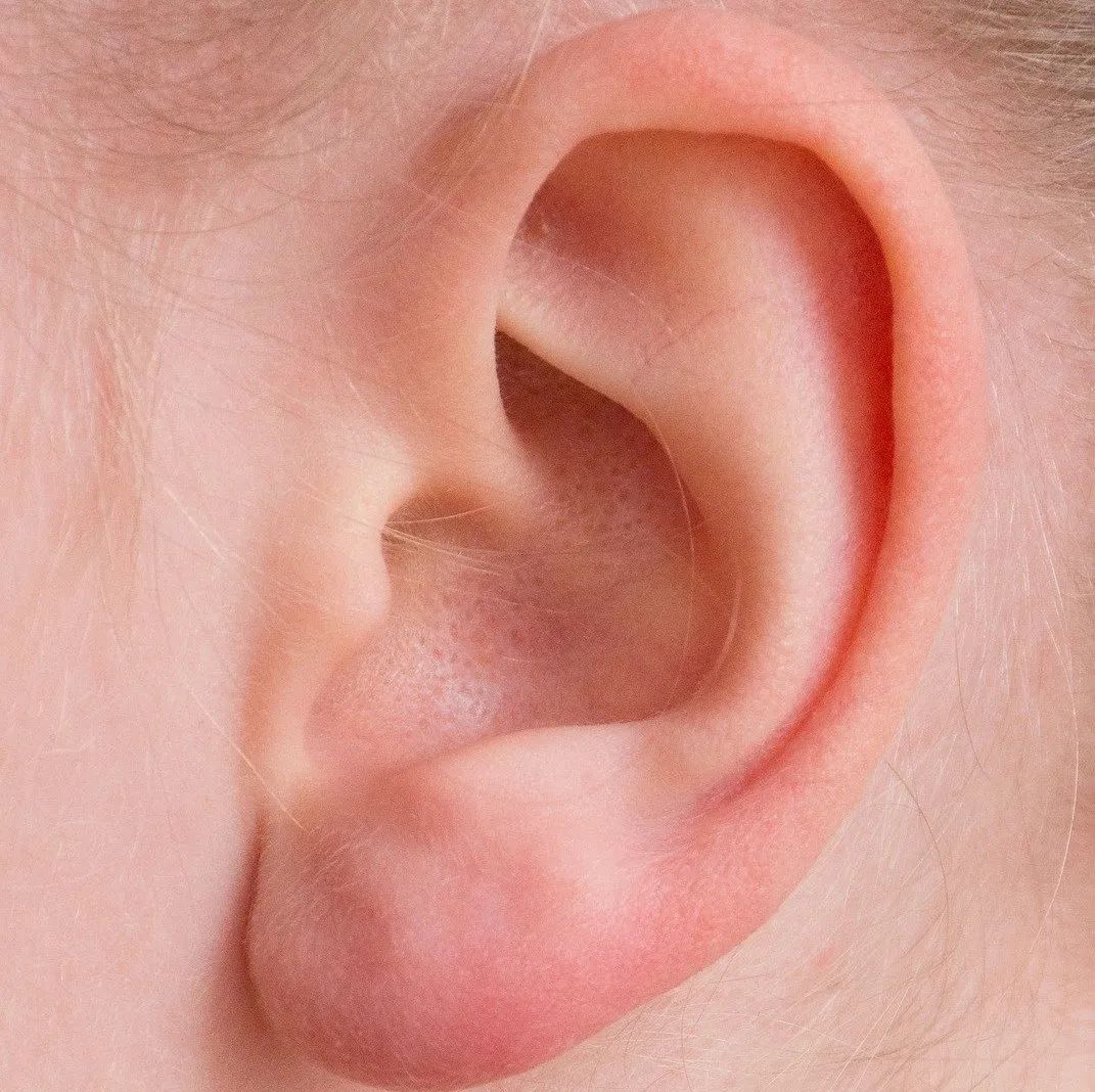 生まれつきの耳の異常「副耳」って何？1歳で切除に踏み切ったワケ | ぎゅってWeb